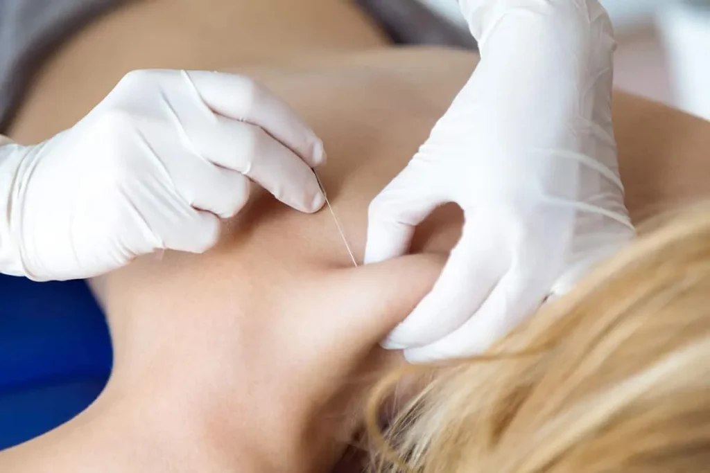 Trigger Point Shots Side Effects: Essential Facts