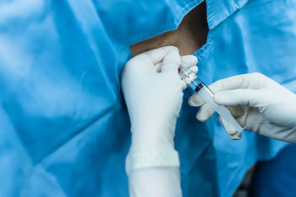 Injection For Sciatica Pain: Incredible Results