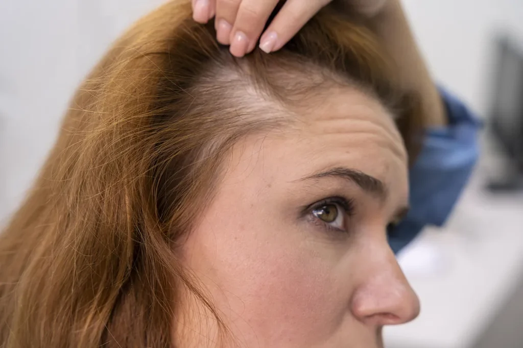 Diffuse Hair Thinning: Best Proven Fixes