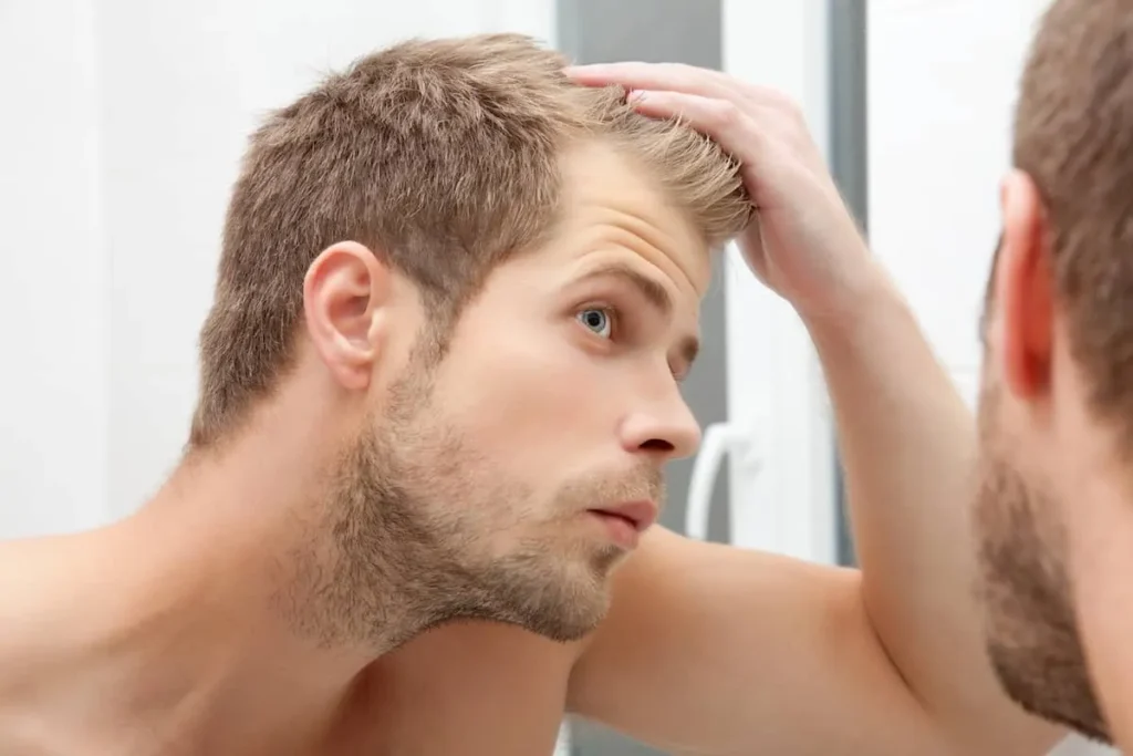 Direct Hair Implantation: Amazing Results