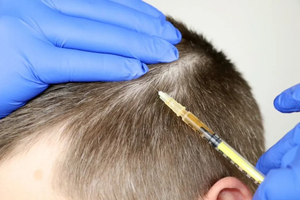 How To Tell If Your Hairline Is Receding: Tips