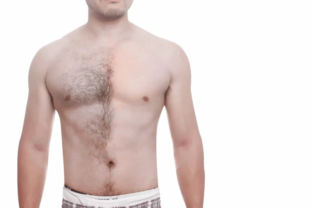 What Causes Loss Of Body Hair In Females