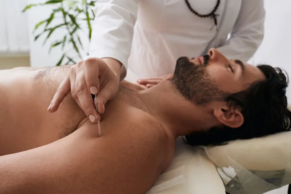 Acupuncture Before Embryo Transfer: Vital Guide