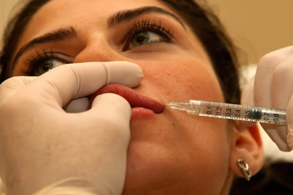 How Long Does Juvederm Lip Filler Last? Guide