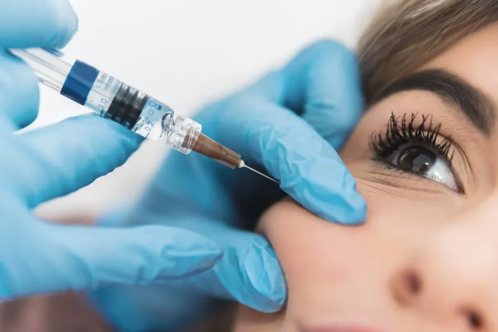 Tear Trough Under Eye Filler Before And After