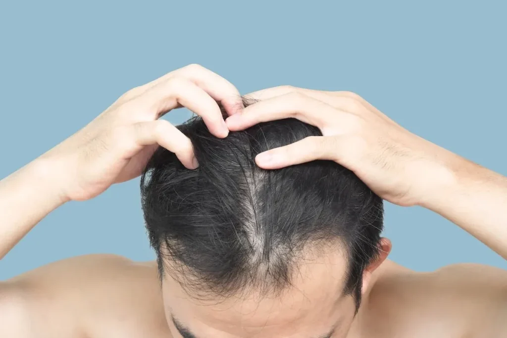 Correct Dosage Of Biotin For Hair Growth