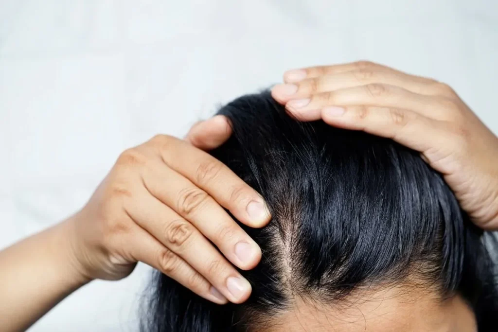 Hair Loss And Skin Rash: 7 Proven Steps
